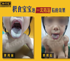  御療堂藥浴積食寶寶對(duì)比舌苔2